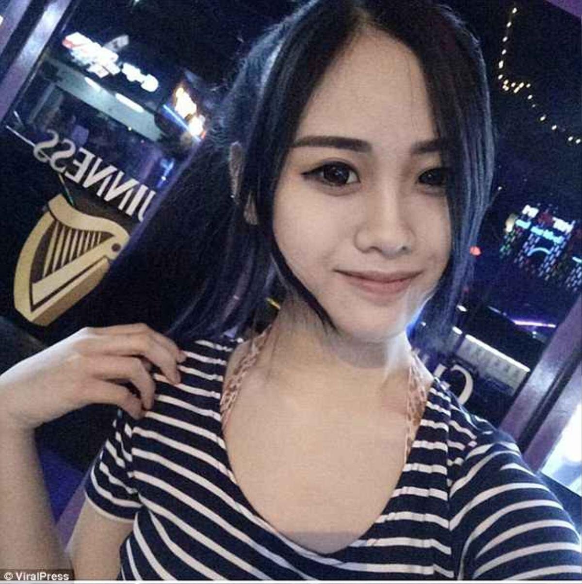 Đang xinh đẹp, 'hot girl' phẫu thuật thẩm mỹ khiến gương mặt như người ngoài hành tinh Ảnh 2