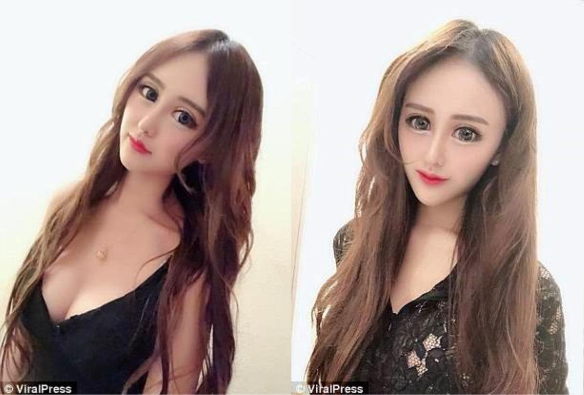 Đang xinh đẹp, 'hot girl' phẫu thuật thẩm mỹ khiến gương mặt như người ngoài hành tinh Ảnh 3