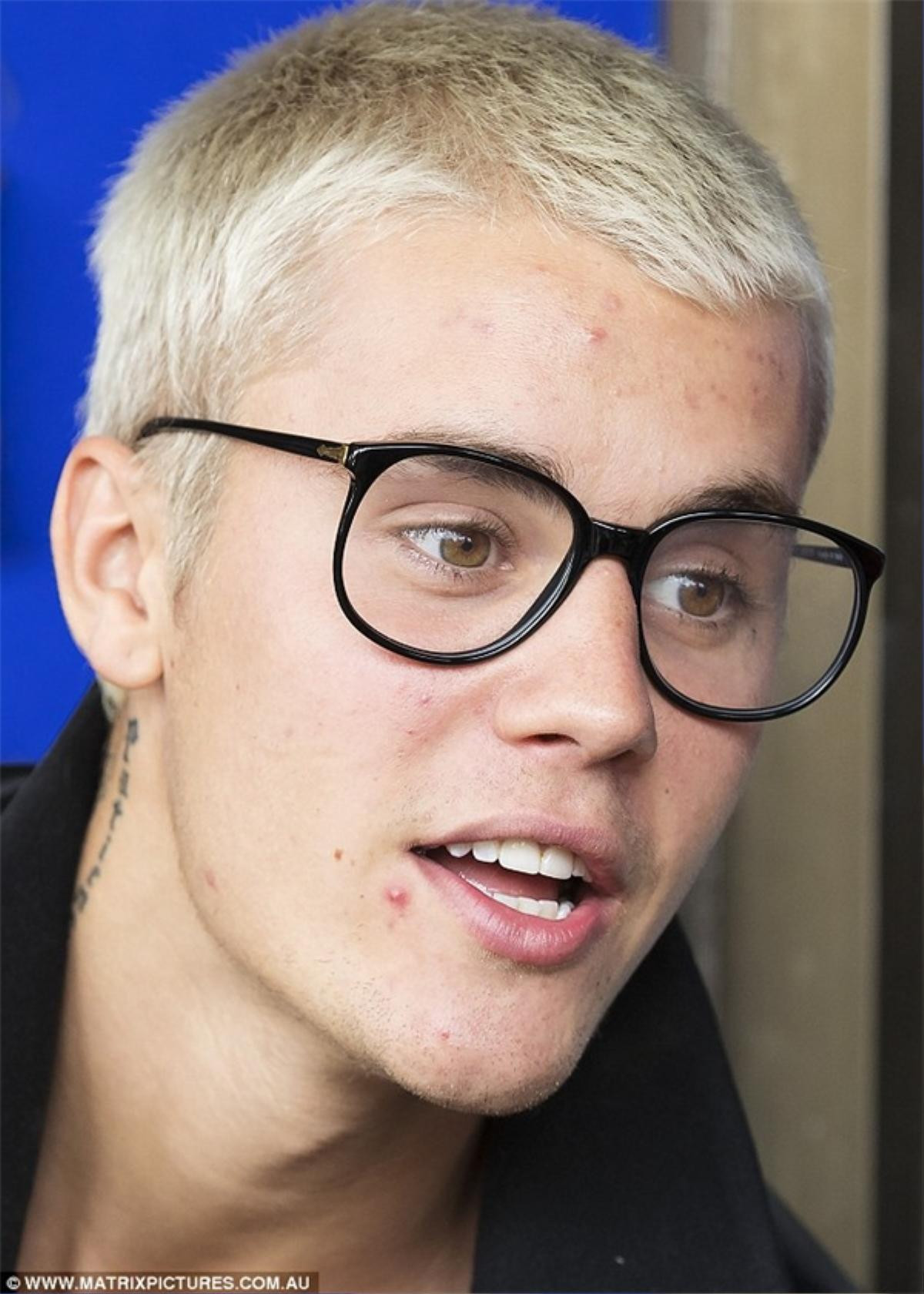 Justin Bieber: 'Hoàng tử' nhạc pop 'chúng ta cùng theo đuổi' năm nào giờ xuống sắc 'tàn tạ' khó nhận ra Ảnh 12