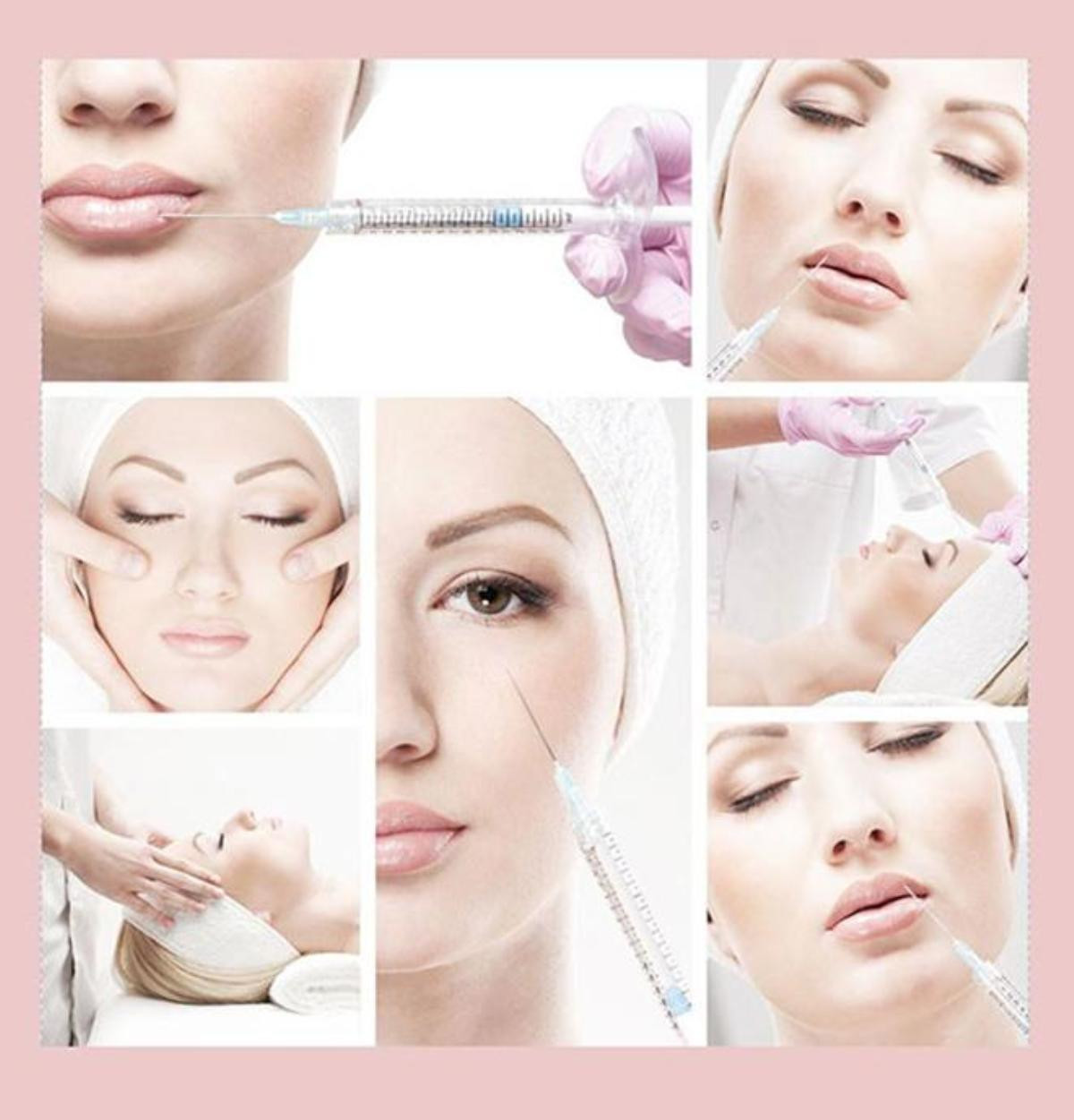 Đây là lý do sao Việt ồ ạt tiêm filler Ảnh 1