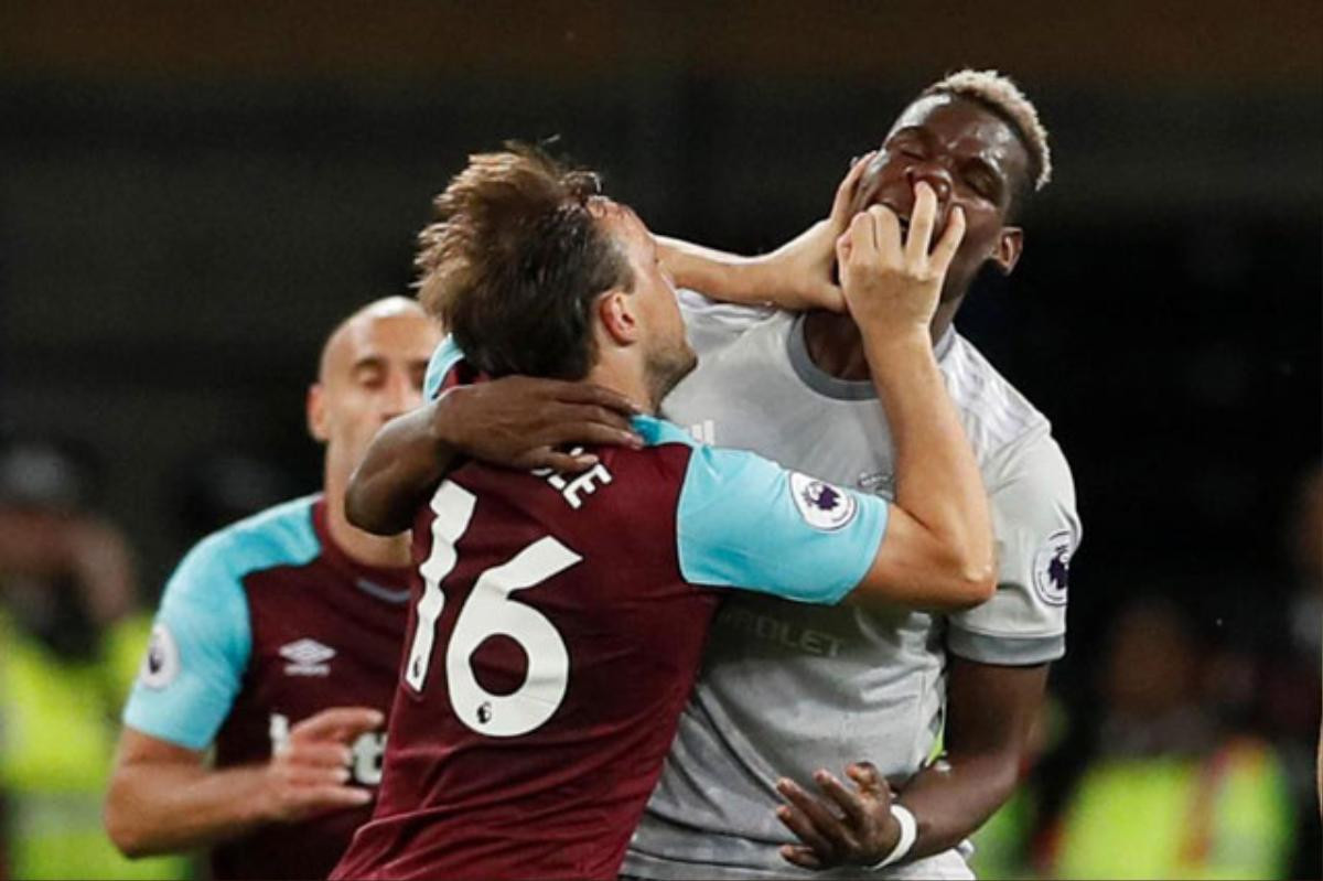 Pogba bị đội trưởng West Ham móc mũi và bóp cổ Ảnh 1