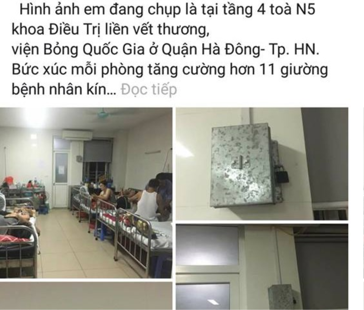 Thực hư bệnh nhân muốn bật điều hoà phải nộp 100 nghìn đồng/ngày ở Viện bỏng Quốc gia Ảnh 1