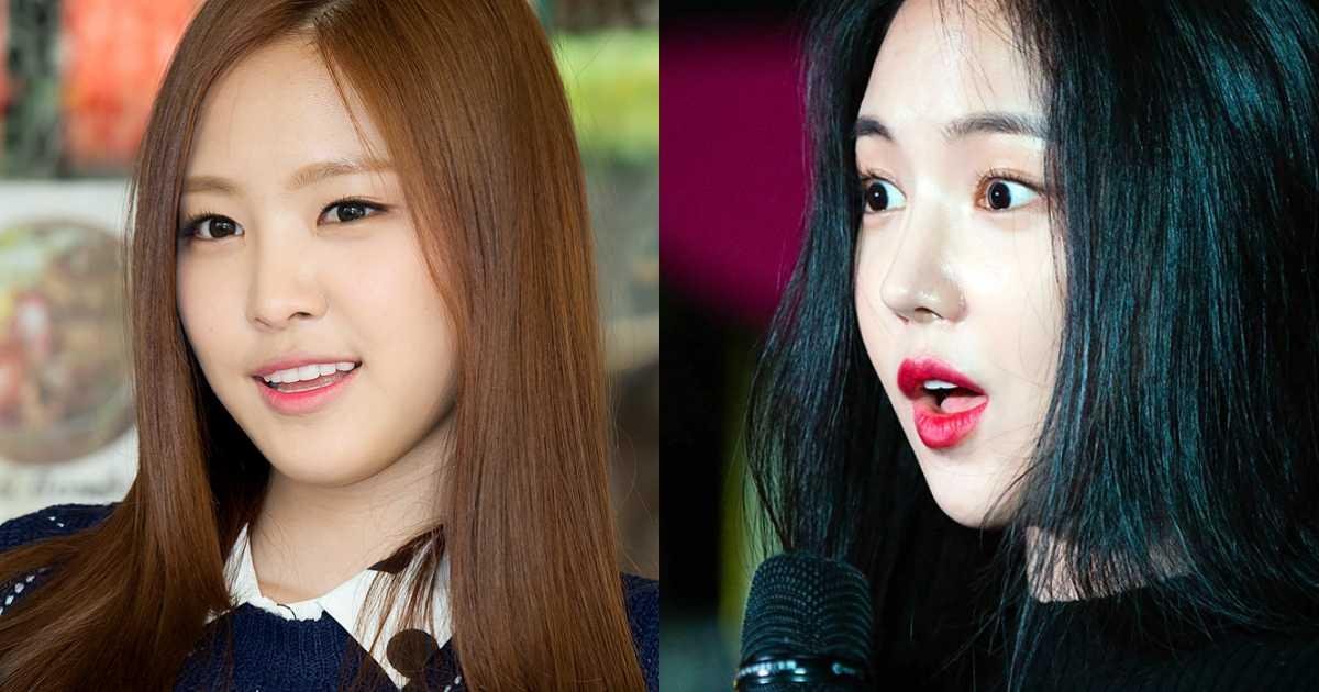 Son Naeun (Apink) hứng chịu gạch đá vì tin đồn phẫu thuật thẩm mĩ Ảnh 4