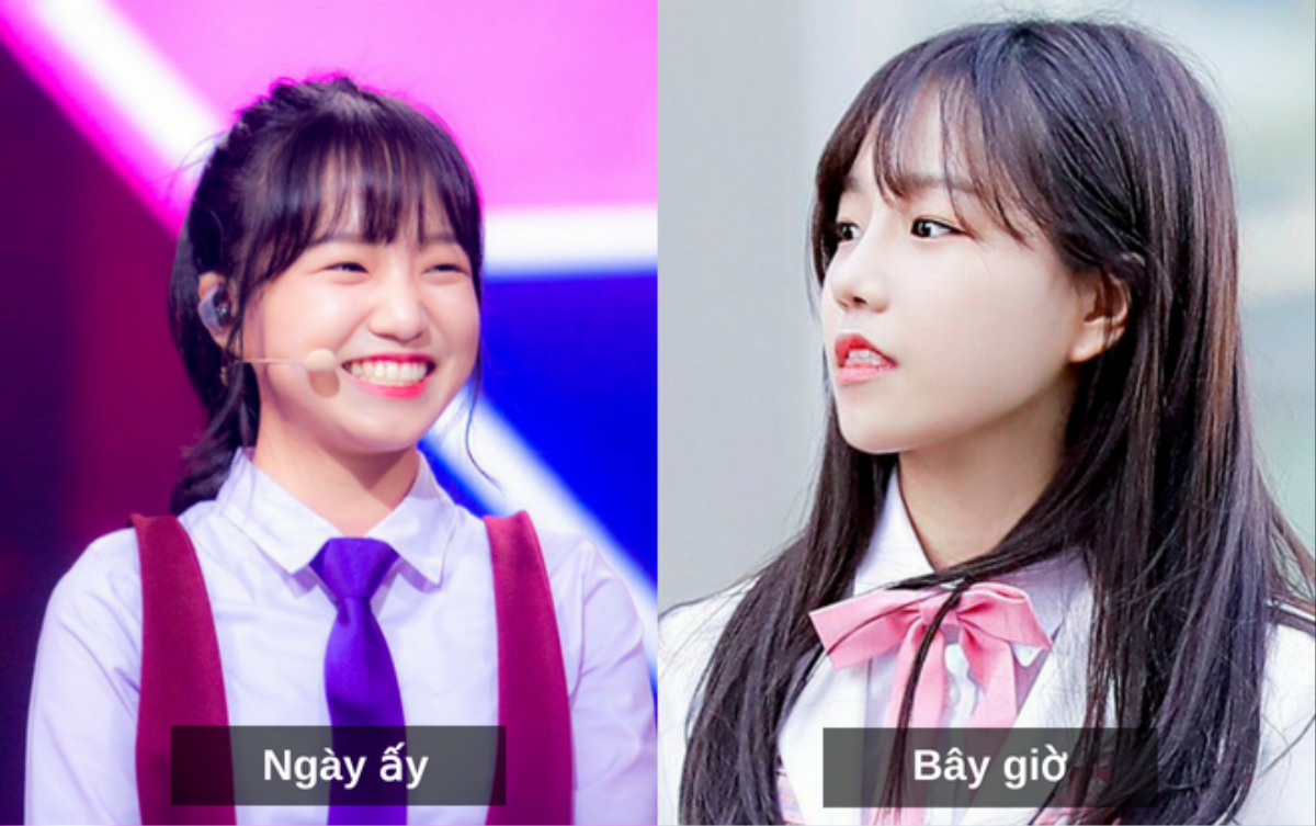 Thí sinh ‘Produce 48’, Yuri bị chỉ trích thậm tệ vì tin đồn phẫu thuật thẩm mĩ Ảnh 3