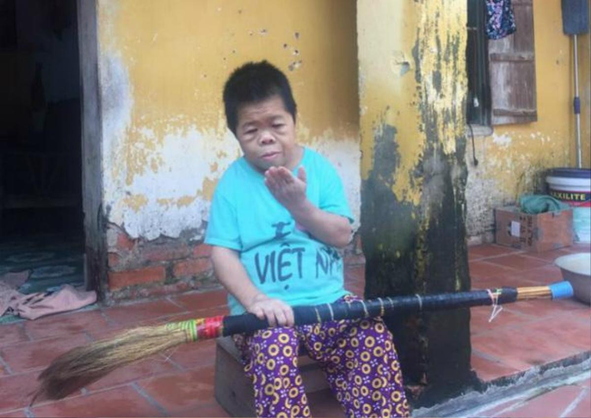 'Cô gái Sọ Dừa' mang hình hài trẻ 4 tuổi: Người mẹ vẫn chờ đợi, con cứ mãi ngây ngô Ảnh 4