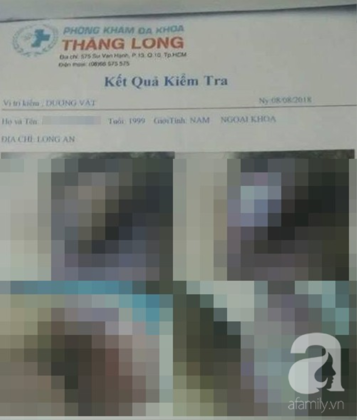 Nam thanh niên 18 tuổi tố phòng khám có bác sĩ Trung Quốc dọa bị u 'vùng kín' để chiếm đoạt tiền Ảnh 2