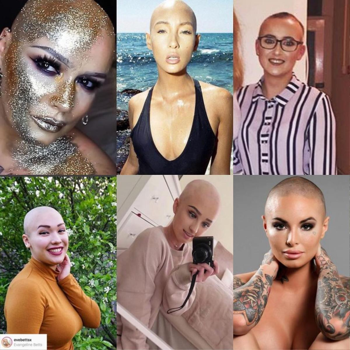 Người mẫu trọc đầu và phong trào #AlopeciaIsFashion đầy ý nghĩa nhăn văn Ảnh 1