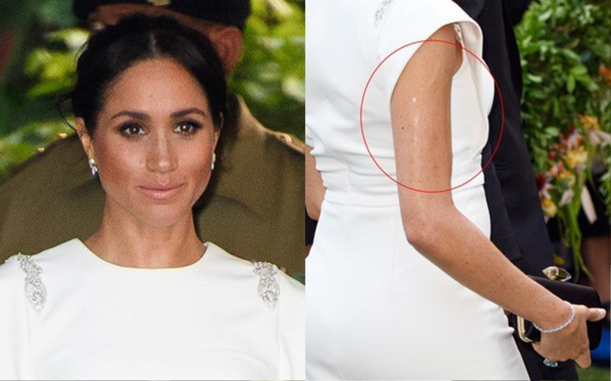 Meghan bị soi cánh tay bóng nhẫy như bôi mỡ, thực chất đây là lý do khiến ai cũng bất ngờ Ảnh 1