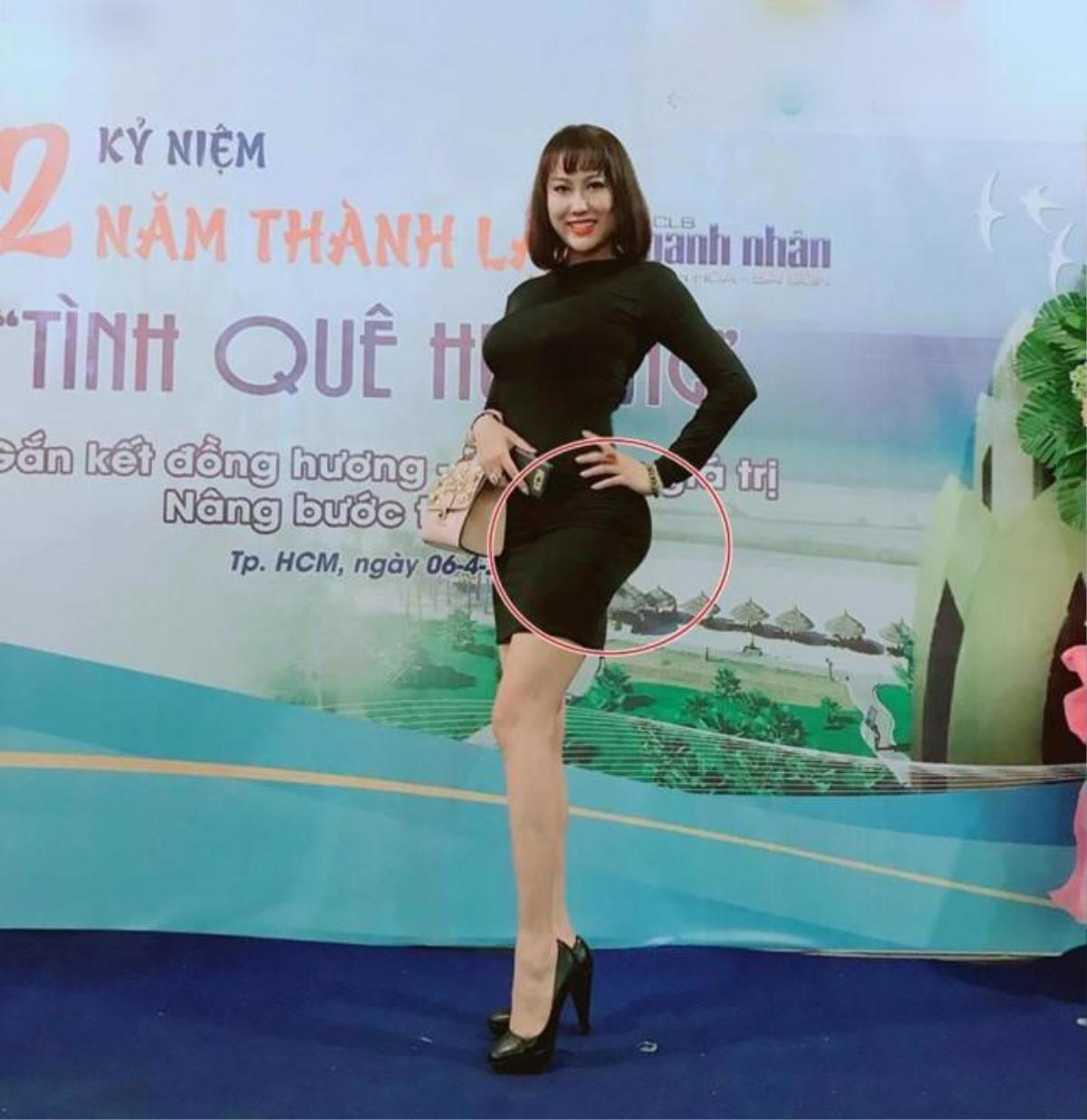 Cứ ngỡ Phi Thanh Vân phẫu thuật thẩm mỹ nhiều nhất, hóa ra 2 sao nữ này còn chẳng nhớ nổi số lần dao kéo Ảnh 8