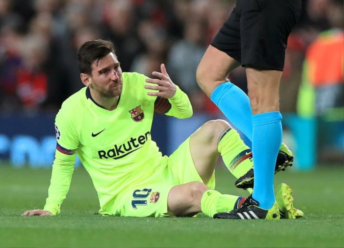 Cận cảnh tình huống Messi 'đổ máu' trong tình huống va chạm với Smalling Ảnh 6