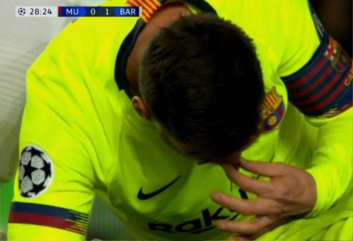 Cận cảnh tình huống Messi 'đổ máu' trong tình huống va chạm với Smalling Ảnh 2