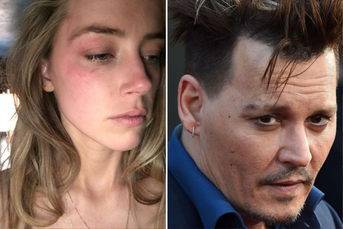 Amber Heard chia sẻ về những ngày kinh hoàng bên cạnh 'Quái vật' mang tên Johnny Depp trong phiên tòa mới nhất Ảnh 3