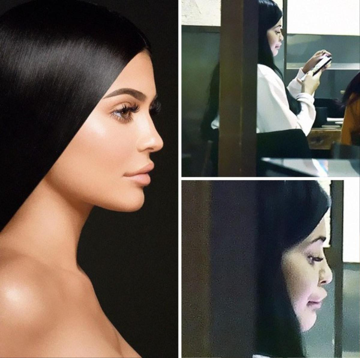 Không photoshop, nhan sắc thật của Kylie Jenner có khiến bạn thất vọng? Ảnh 1