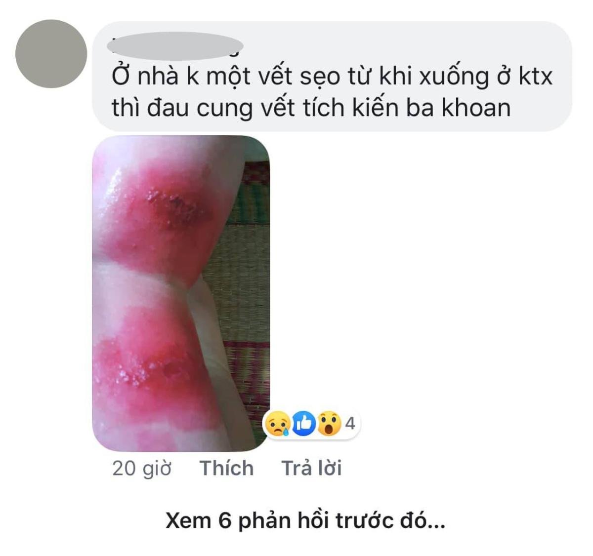 Sinh viên KTX ĐHQG TP.HCM lo lắng vì liên tục bị kiến ba khoang 'tấn công' Ảnh 1