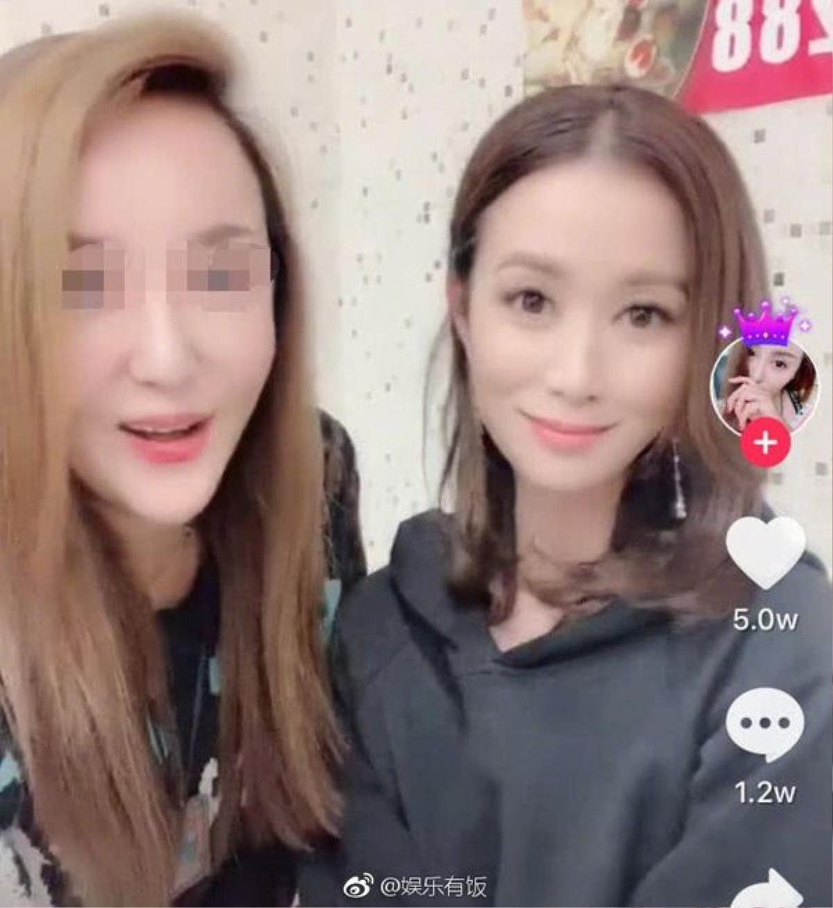 Livestream giao lưu với fan, Quan Hiểu Đồng lộ mặt cứng đơ, do app hay là di chứng của phẫu thuật thẩm mỹ? Ảnh 8