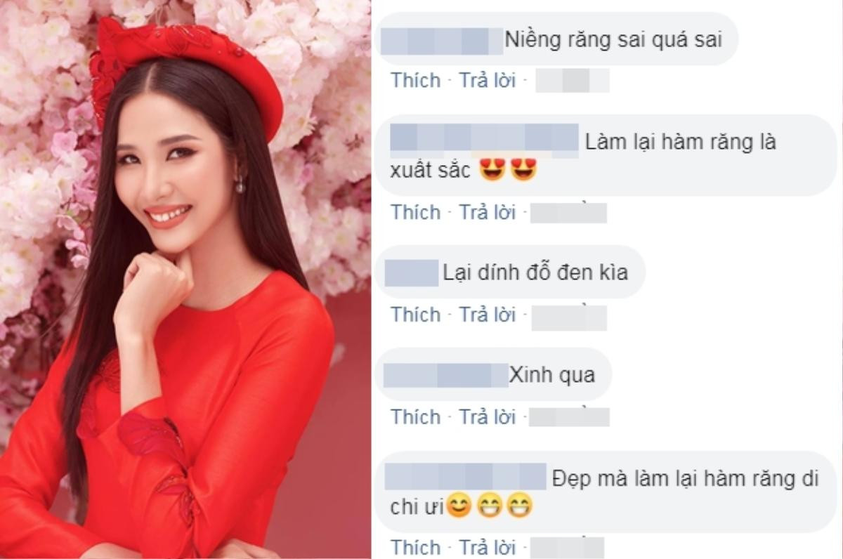 Fan chê cười xấu, Hoàng Thùy niềng răng 'cấp tốc' chuẩn bị chinh chiến Miss Universe 2019 Ảnh 3