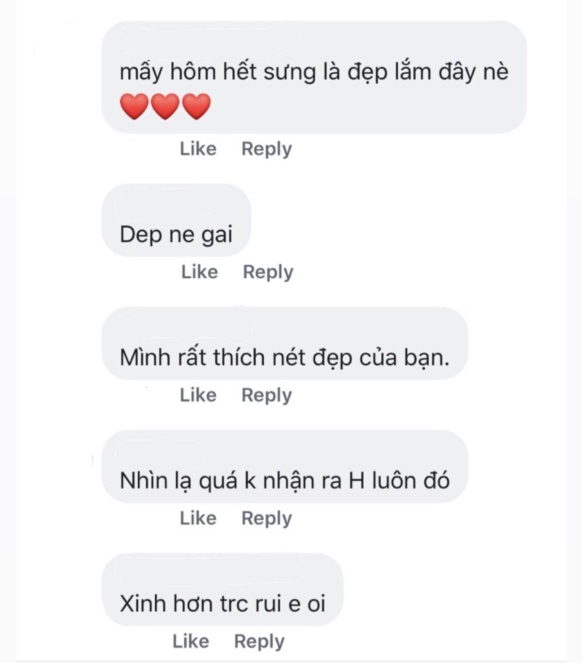 Kỳ Hân khoe ảnh mặt còn sưng húp sau phẫu thuật thẩm mỹ Ảnh 6