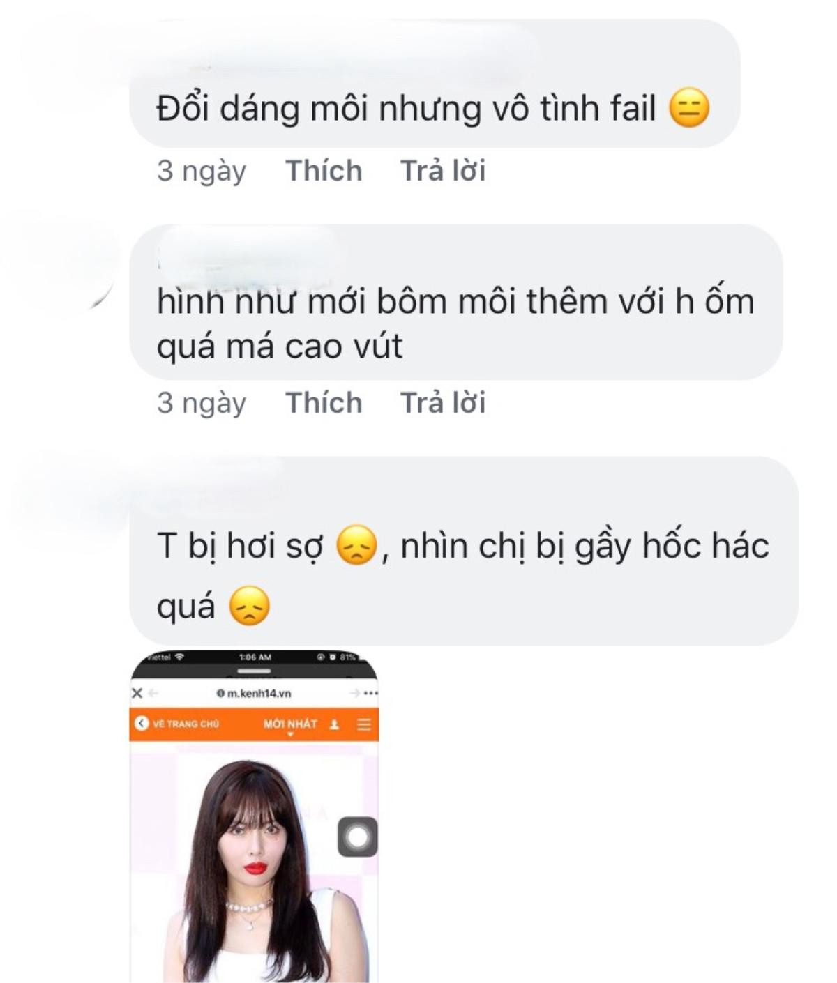 Fan tiếc hùi hụi khi HyunA ngày càng gầy gò cộng thêm cặp môi xúc xích 'khó tiêu' Ảnh 4