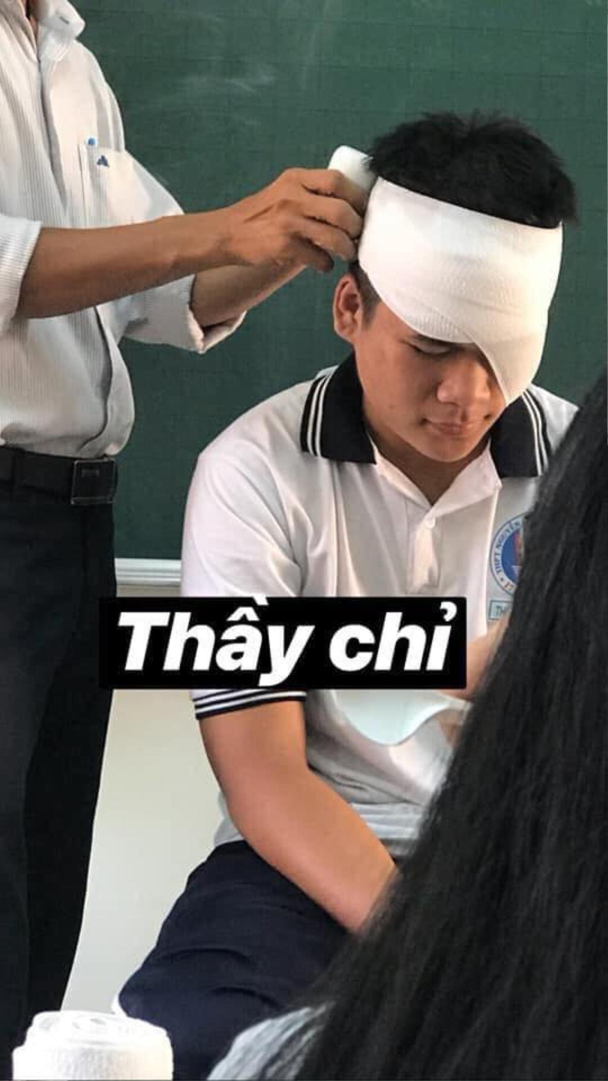 Loạt ảnh 'thầy chỉ' và 'học sinh làm' khi băng bó vết thương trong kỳ học quân sự khác nhau '1 trời 1 vực' khiến CĐM cười lăn Ảnh 1