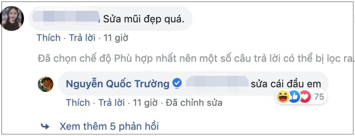 Quốc Trường 'giận dỗi' đăng ảnh cận mặt để chứng minh mình không sửa mũi Ảnh 3