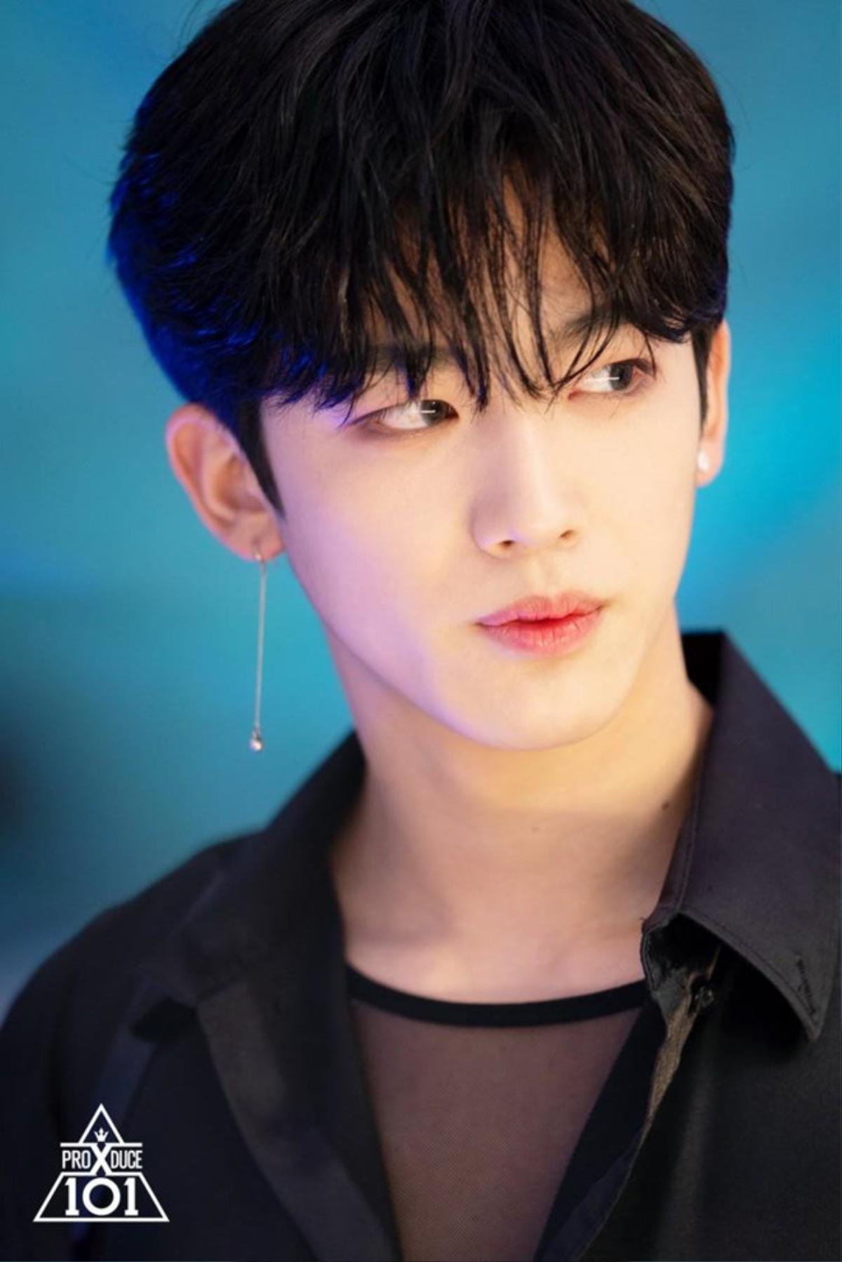 Bị thương nhập viện trong sân khấu debut đầu tiên của X1, hành động này của Kim Yohan khiến fan vừa xót xa, vừa cảm phục Ảnh 2