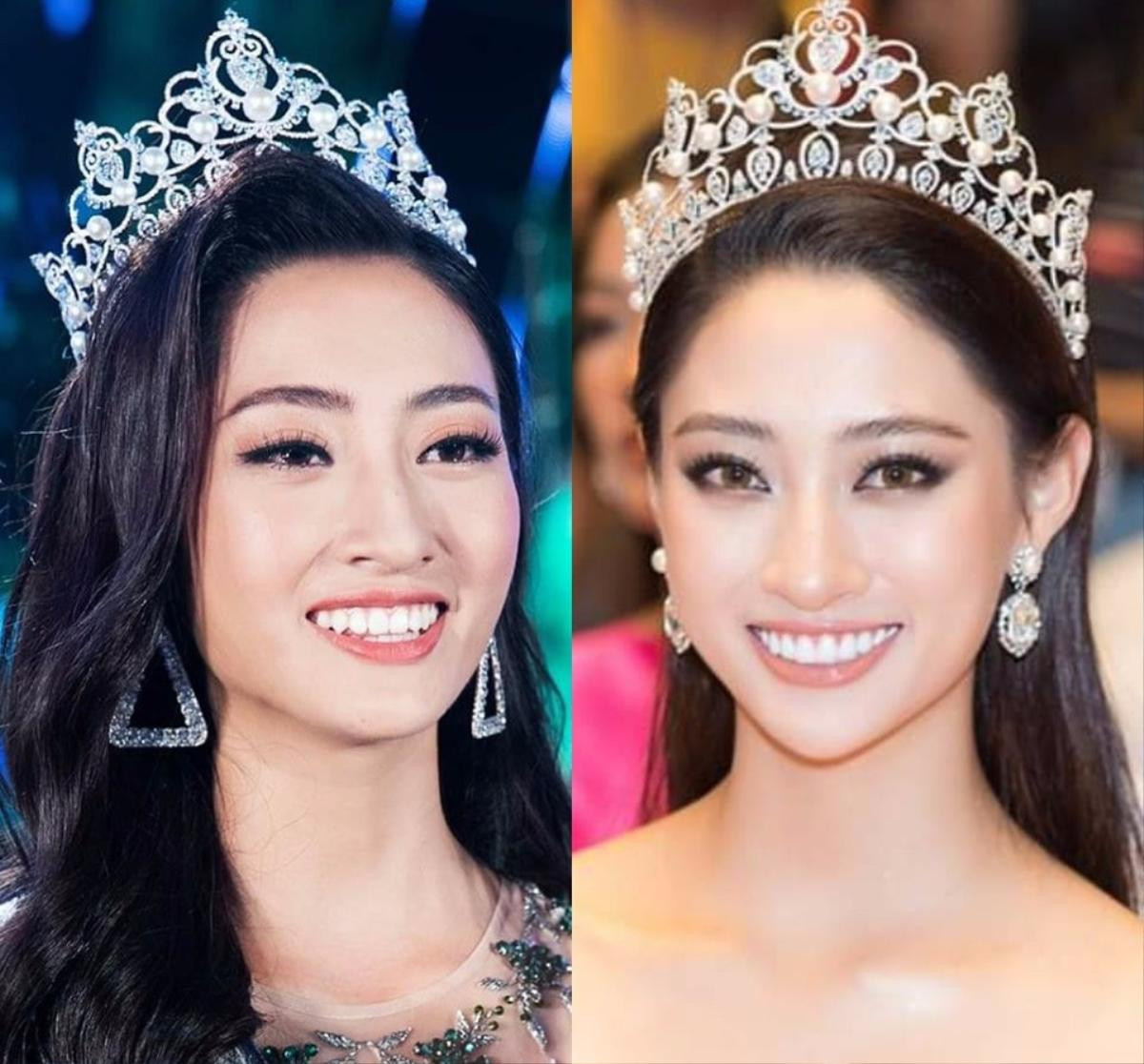 Rộ tin đồn hoa hậu Lương Thùy Linh làm lại răng sau 1 tháng đăng quang Miss World Vietnam Ảnh 1