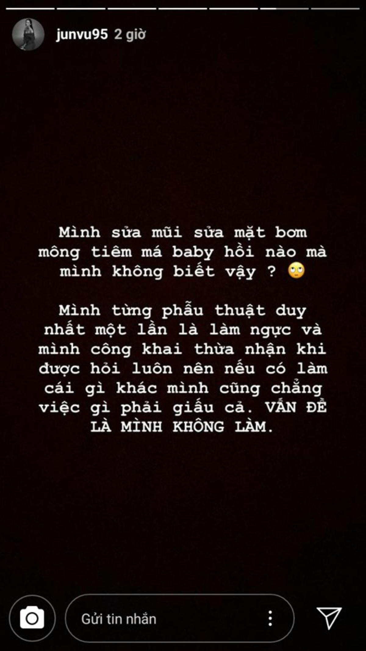 Bị 'tố' phẫu thuật thẩm mỹ toàn bộ gương mặt, Jun Vũ bức xúc 'đáp trả' anti-fan và khẳng định chỉ 'dao kéo' một chỗ duy nhất Ảnh 1