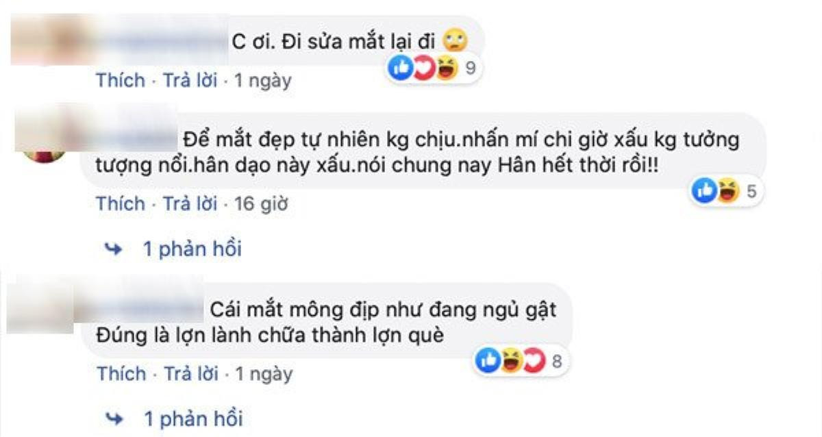 Gương mặt khác lạ 'thiếu tự nhiên' của Kỳ Hân sau phẫu thuật thẩm mỹ khiến dân mạng xôn xao Ảnh 3