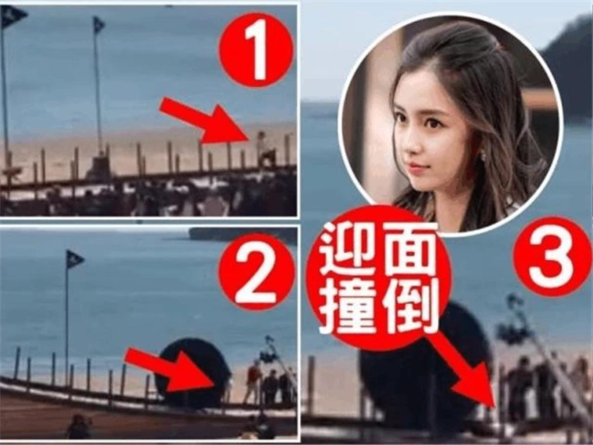 Vì tham gia show Keep Running của đài Chiết Giang, Angelababy bị thương tật vĩnh viễn ở ngón áp út Ảnh 8