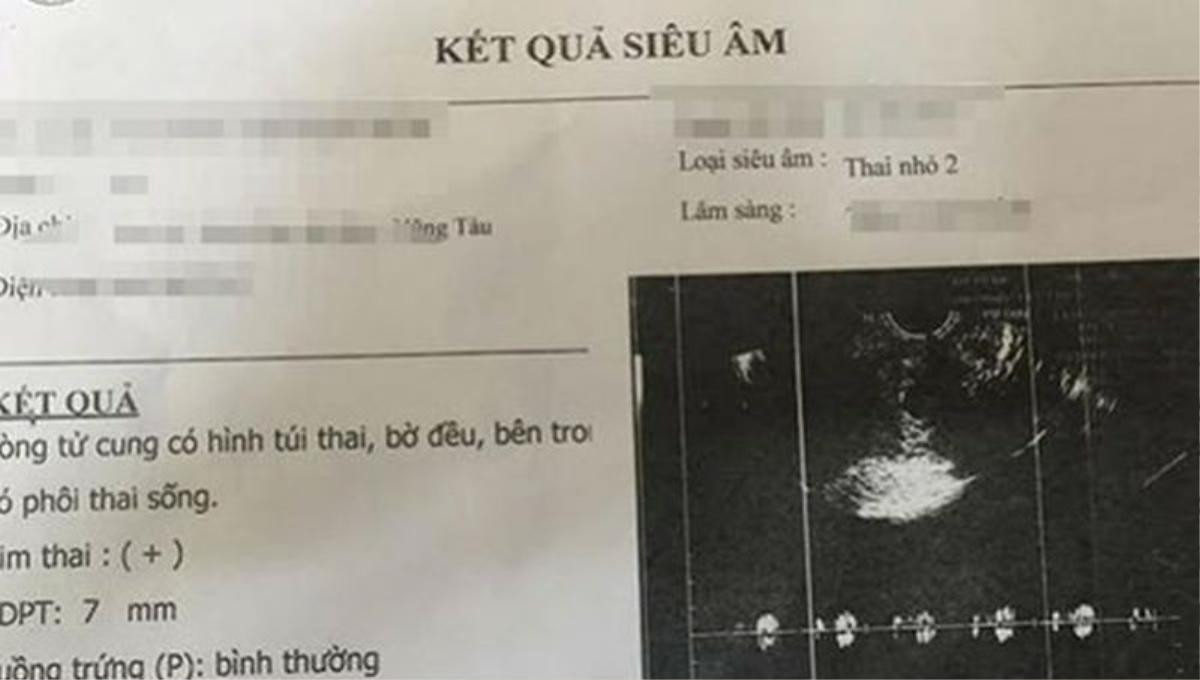 Thiếu nữ 15 tuổi làm giả giấy siêu âm thai để níu kéo tình cảm Ảnh 1