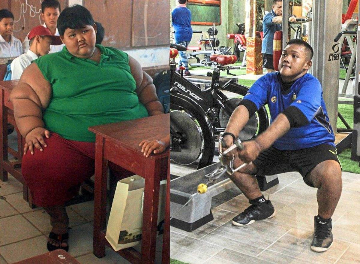 'Đứa trẻ béo nhất thế giới' giảm 100 kg trong hơn 3 năm Ảnh 1