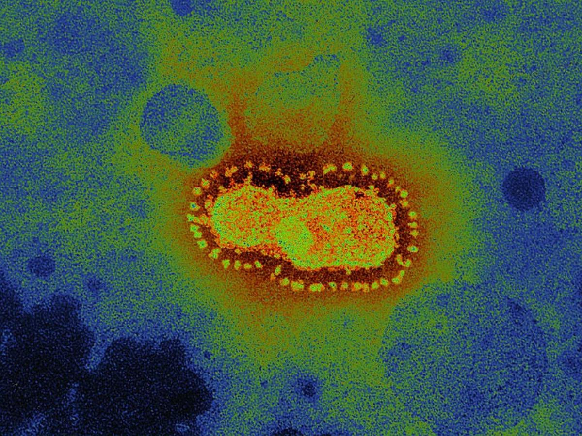 Nguy hiểm là thế nhưng virus corona vẫn bị nhiều người lầm tưởng với một loại bia ở Bắc Mỹ Ảnh 3