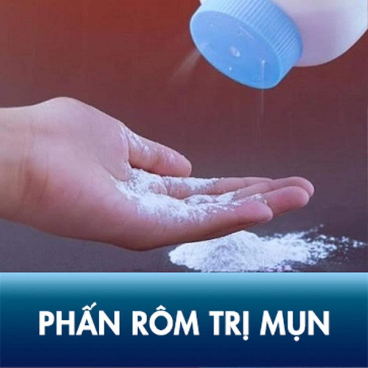 Sau tất cả đây là 3 cách trị mụn bằng phấn rôm hiệu quả nhất bạn cần bỏ túi Ảnh 1