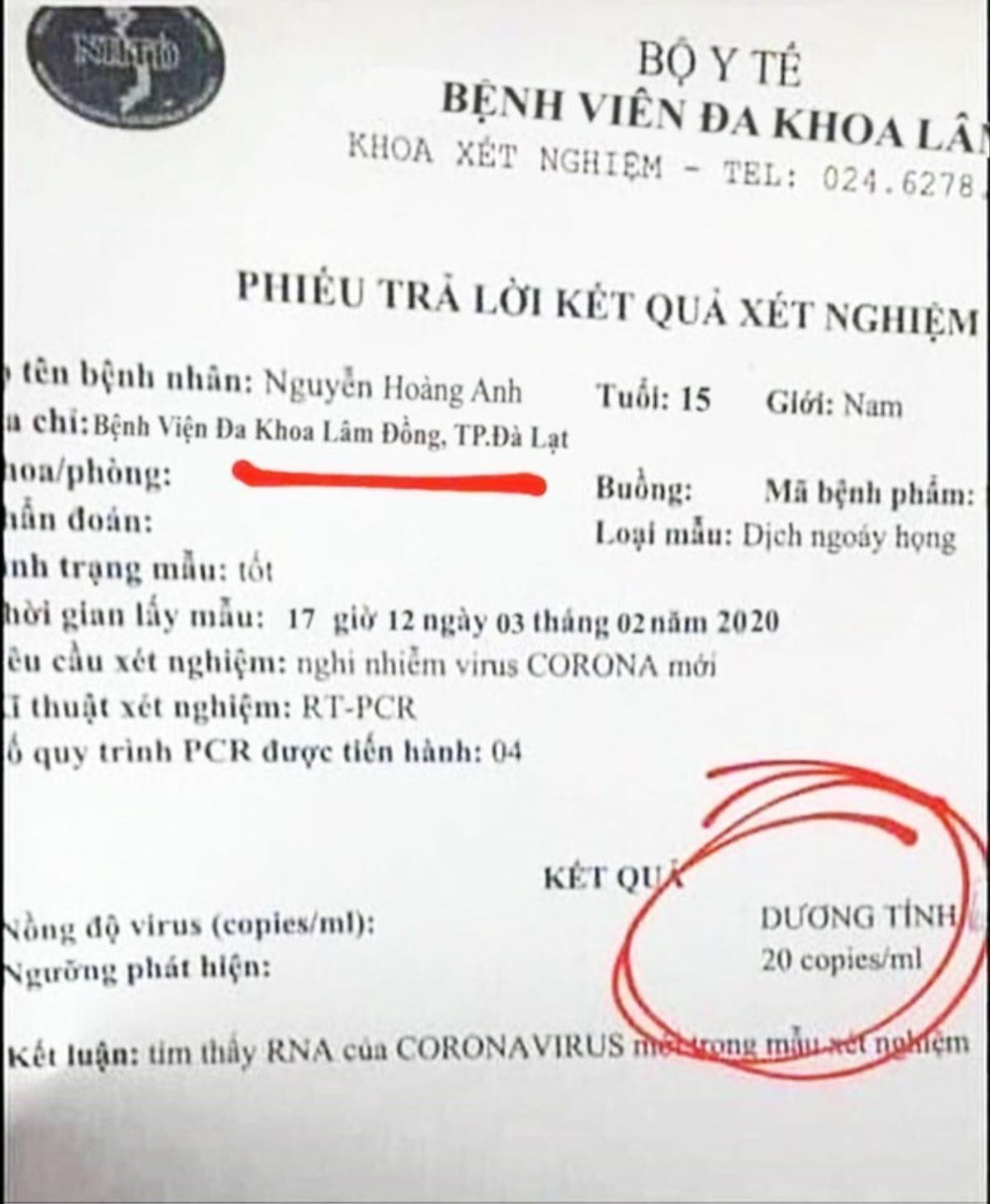 6 học sinh THPT làm giả phiếu xét nghiệm nhiễm virus corona để trêu đùa Ảnh 1