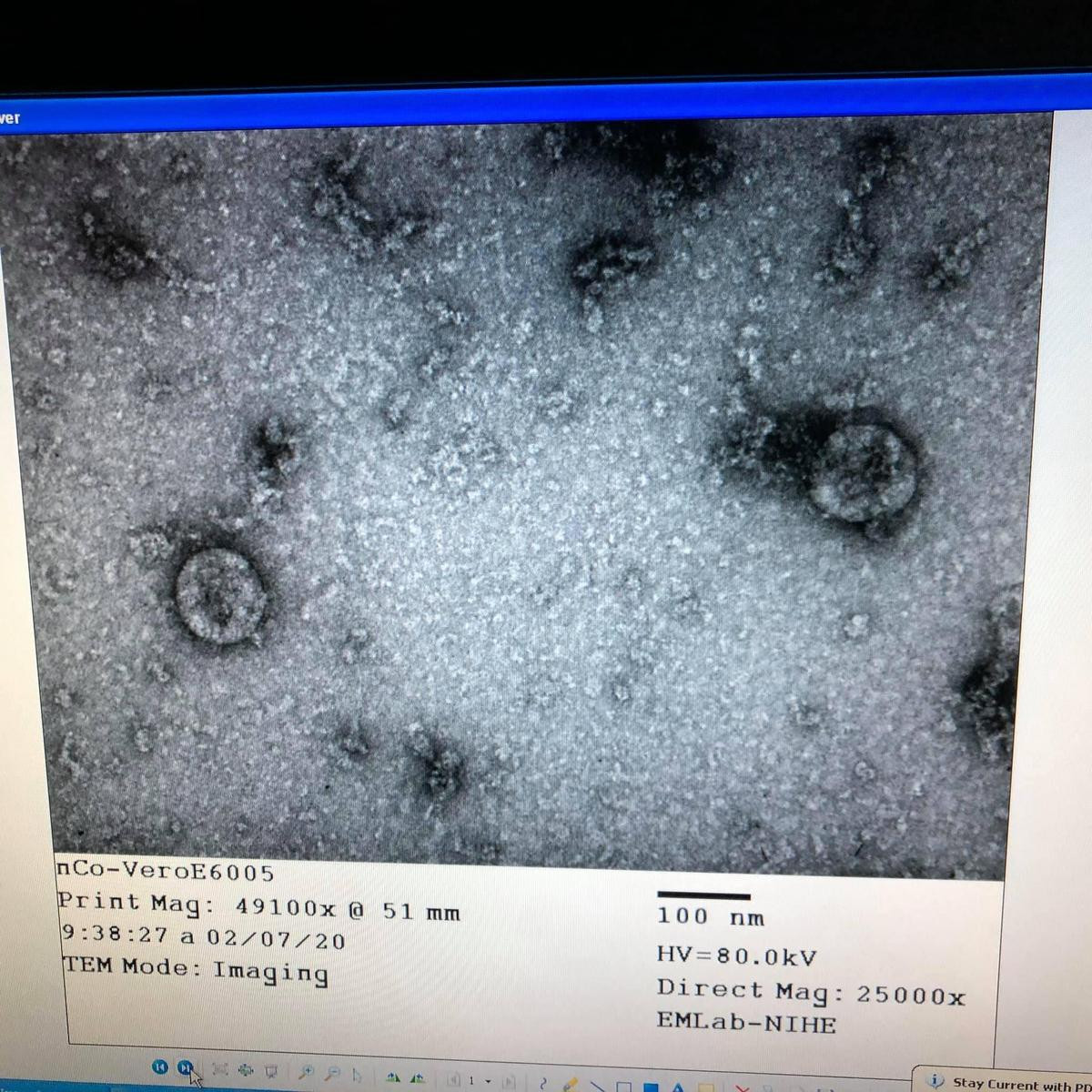 Việt Nam nuôi cấy và phân lập thành công virus corona mới Ảnh 1