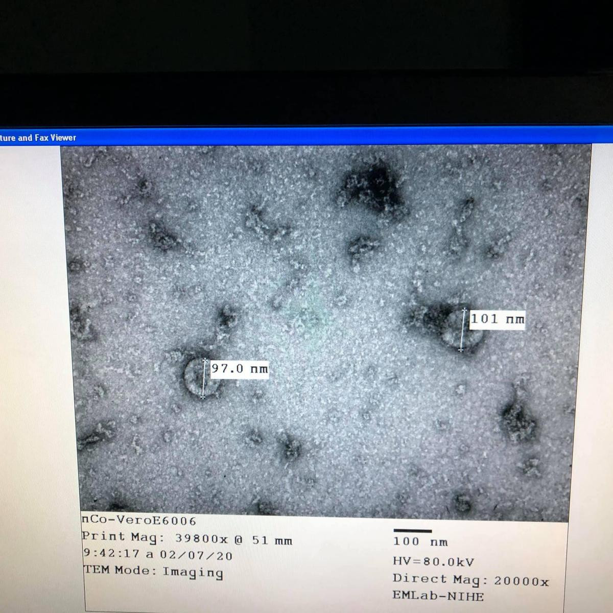 Việt Nam nuôi cấy và phân lập thành công virus corona mới Ảnh 3