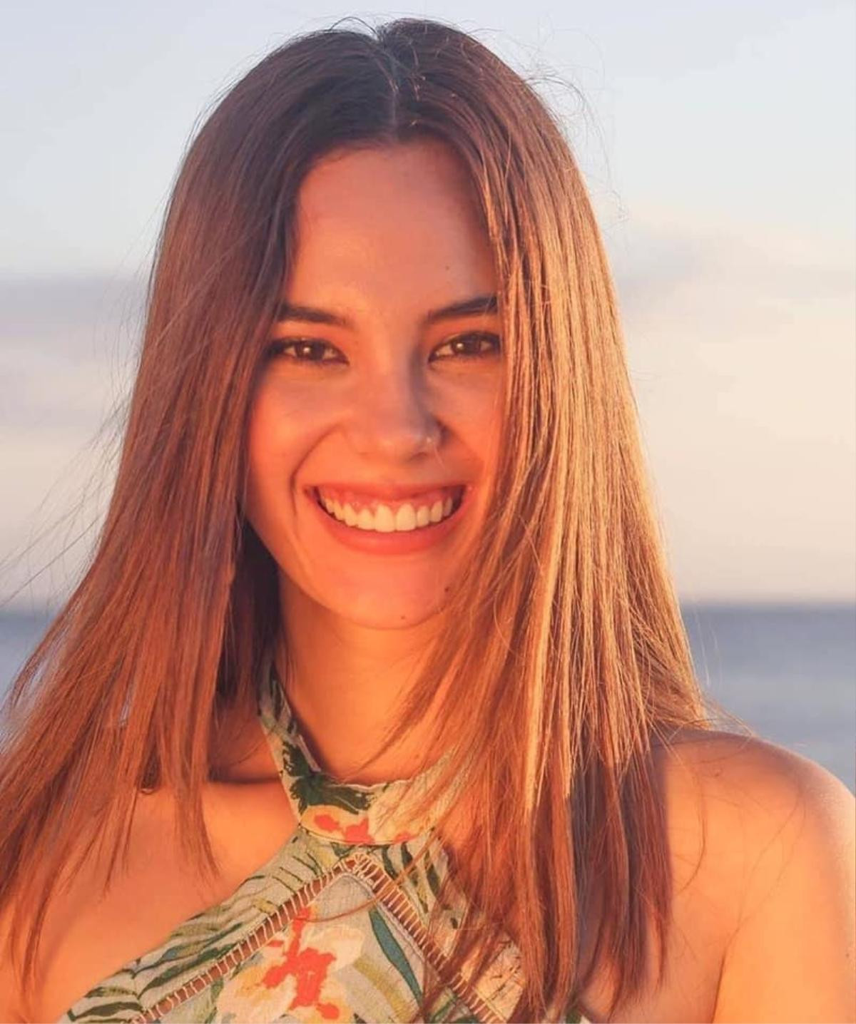 Cùng mang khuyết điểm trên gương mặt: Lương Thùy Linh nhanh chóng sửa, Catriona Gray quyết giữ nguyên Ảnh 3