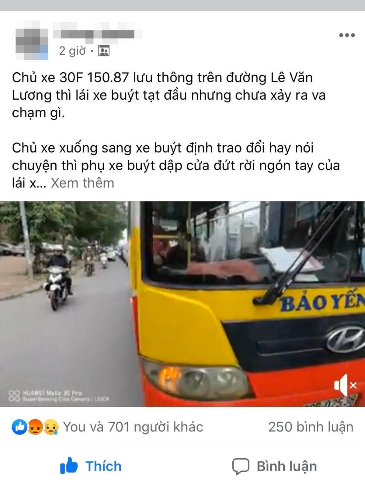 'Nhắc nhở’ xe buýt tạt đầu xe, tài xế ô tô con bị kẹp đứt lìa ngón tay Ảnh 1