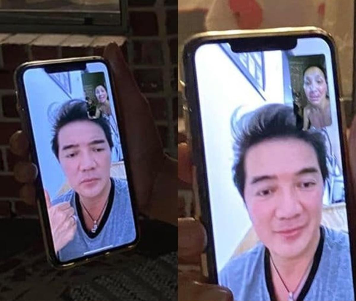 Hồng Ngọc lộ gương mặt bị bỏng nặng qua màn hình facetime cùng Đàm Vĩnh Hưng Ảnh 1