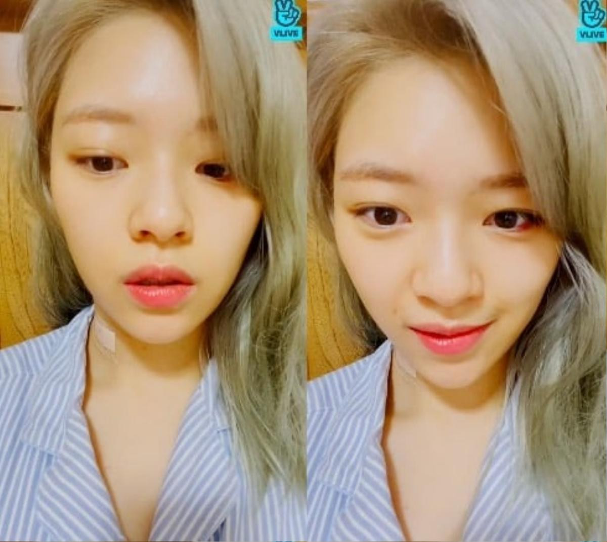 Jeongyeon (Twice) chia sẻ đang đối phó với chấn thương cổ ngay mùa comeback Ảnh 5