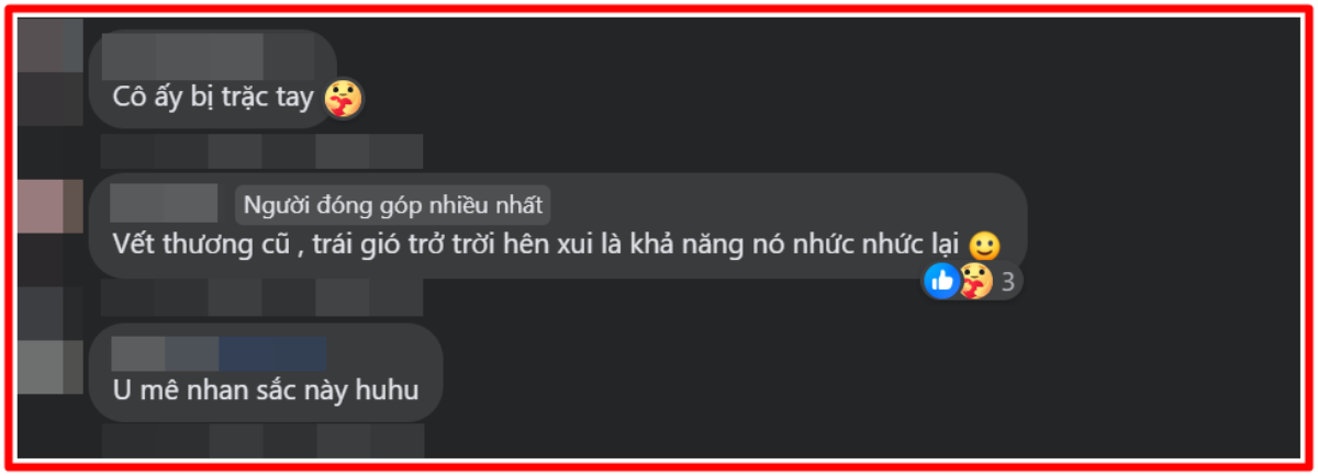 Mỹ Tâm gây xôn xao với hình ảnh bàn tay quấn băng, bị thương vì tập luyện cho đêm nhạc ở Hạ Long? Ảnh 5