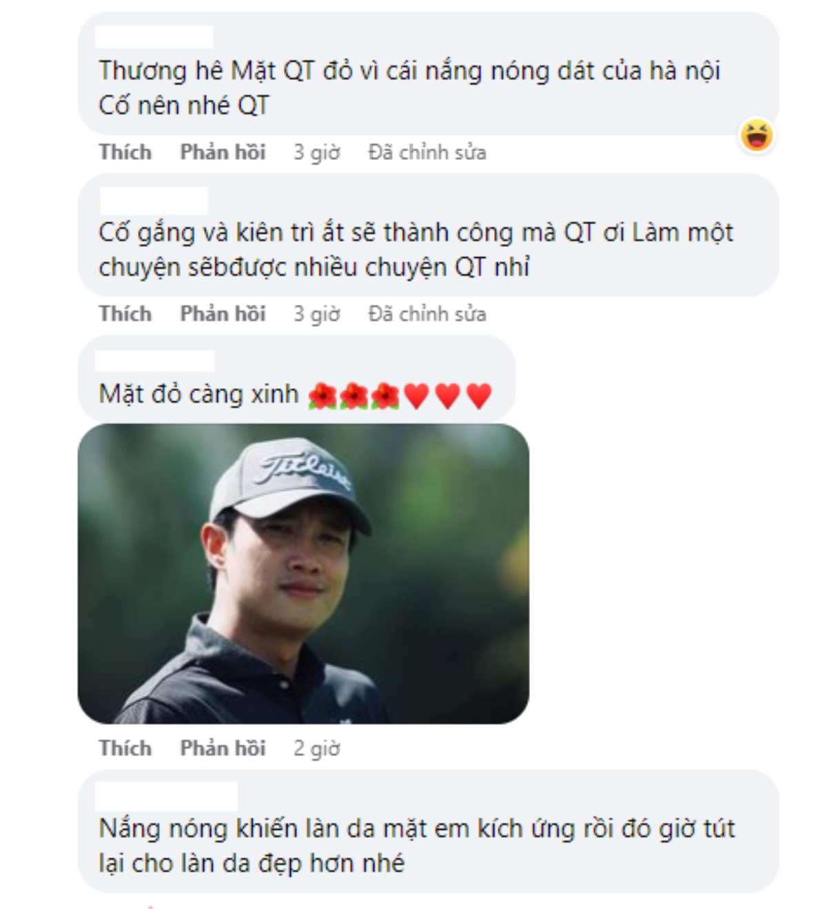 Quốc Trường bị soi diện mạo kém tươi tắn, netizen bàn tán thế nào? Ảnh 3