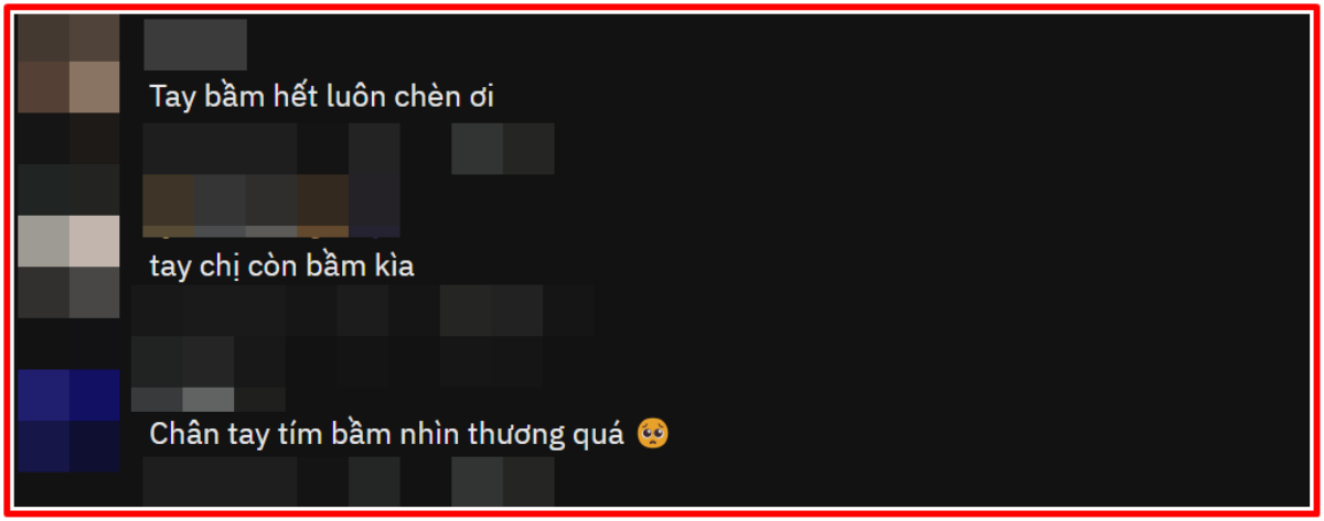 Chi Pu để lộ thương tích khi tham gia Đạp gió tại Trung Quốc khiến khán giả xót xa Ảnh 3