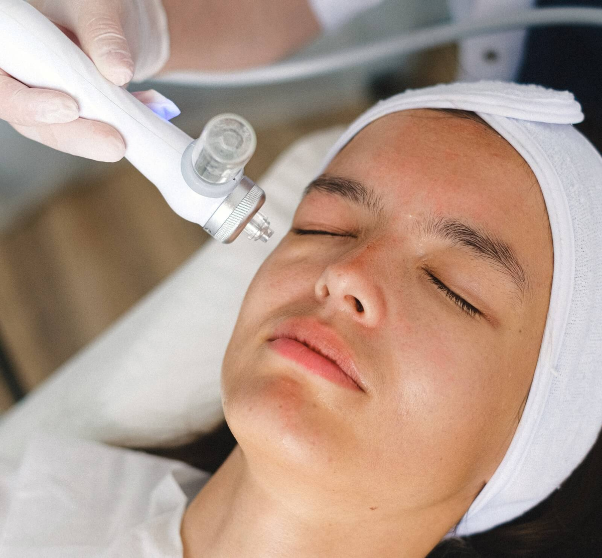 Ultherapy bí quyết nâng cơ không cần dao kéo có đáng thử? Ảnh 1