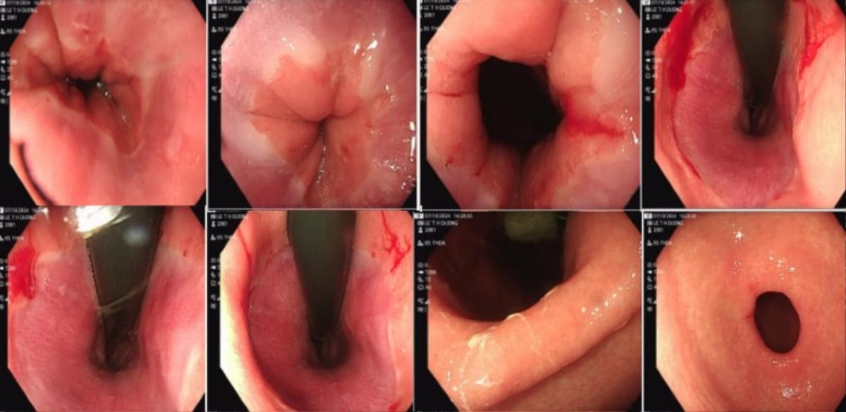 Sau chầu nhậu liên hoan, cô gái ở Hải Dương phải nhập viện gấp Ảnh 2