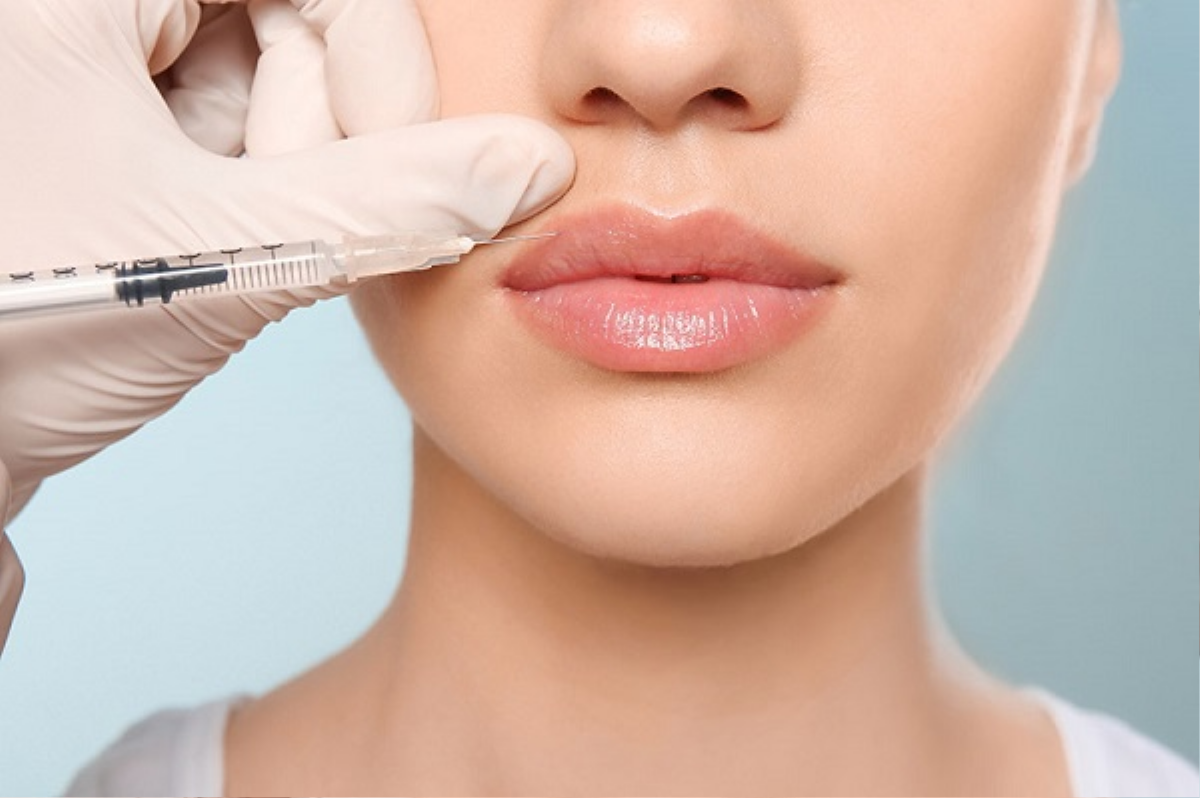 Tác dụng phụ khó tránh khỏi khi tiêm filler Ảnh 1