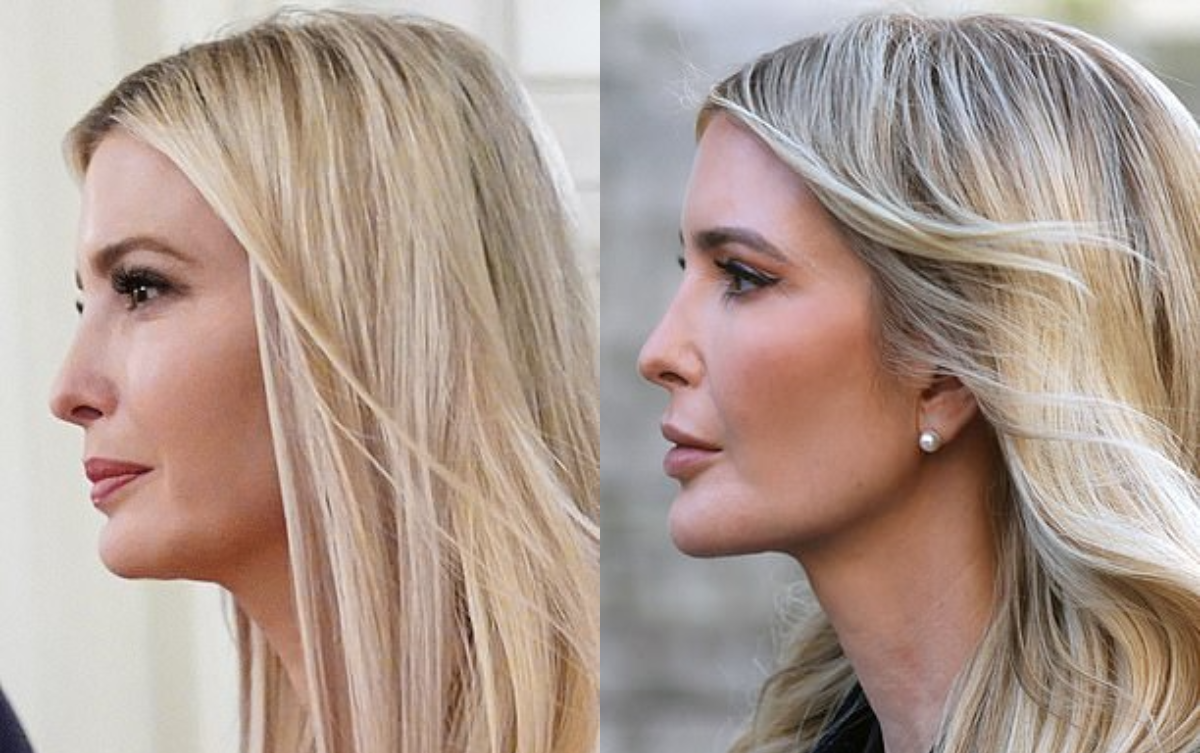 Ivanka Trump đẹp như 'nữ thần' nhờ thẩm mỹ? Ảnh 2