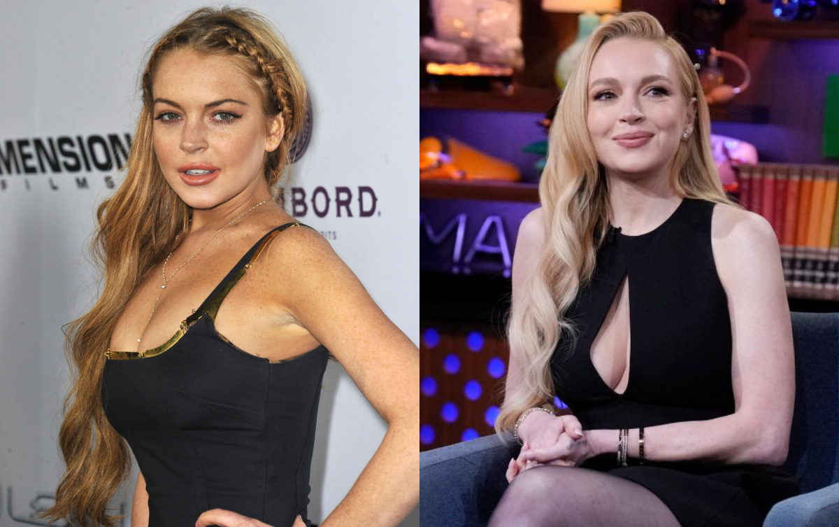 Chuyên gia lý giải màn lão hóa ngược gây chấn động toàn cầu của Lindsay Lohan Ảnh 2