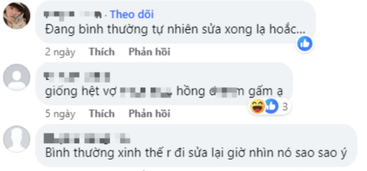 Hot TikTok Gấm Kami công khai diện mạo hậu thẩm mỹ cả mặt, nhan sắc ra sao khiến dân tình tiếc nuối? Ảnh 4