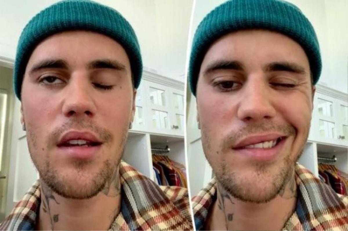 Justin Bieber đăng ảnh nước mắt giàn dụa rồi xóa, fan lập tức tìm ra nguyên nhân Ảnh 4